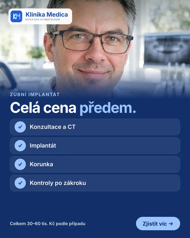 Reklama Klinika Medica: celá cena implantátu předem